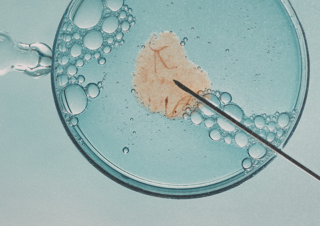 Nutrición para preparar una transferencia embrionaria: crear el terreno fértil